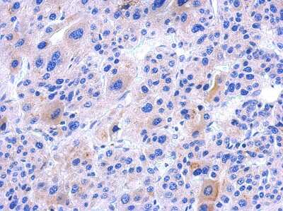 Immunohistochemistry-Paraffin: IFT122 Antibody [NBP2-16925]