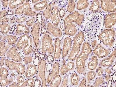 Immunohistochemistry-Paraffin: IFT122 Antibody [NBP2-97508]