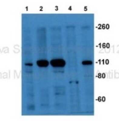 Western Blot: IFT122 Antibody [NBP1-54842]