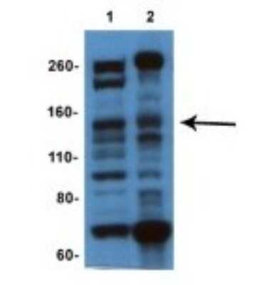 Western Blot: IFT140 Antibody [NBP1-80207]