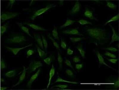 Immunocytochemistry/ Immunofluorescence: IFT20 Antibody (3F3) [H00090410-M02]