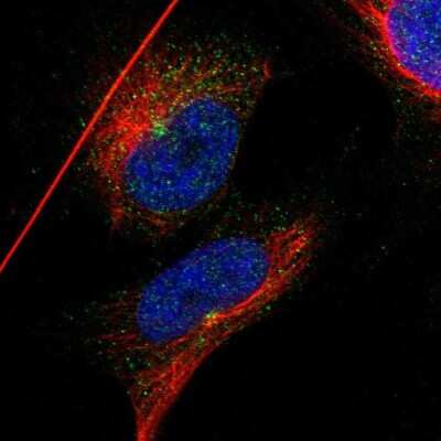 Immunocytochemistry/ Immunofluorescence: IFT81 Antibody [NBP1-84558]