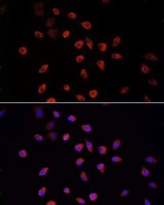 Immunocytochemistry/ Immunofluorescence: IFT88 Antibody - Azide and BSA Free [NBP3-05094]