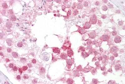 Immunohistochemistry: IFT88 Antibody [NBP2-86675]