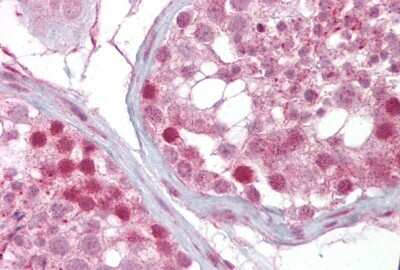 Immunohistochemistry-Paraffin: IFT88 Antibody [NBP1-79538]