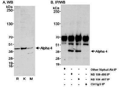 Immunoprecipitation: IGBP1 Antibody [NB100-487]