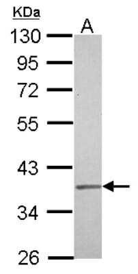 Western Blot: IGBP1 Antibody [NBP2-16928]