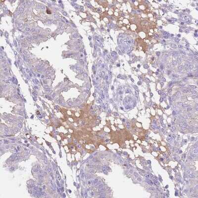Immunohistochemistry-Paraffin: IGF-I/IGF-1 Antibody [NBP2-48922]