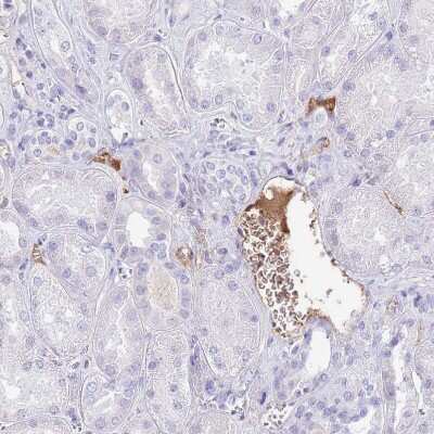 Immunohistochemistry-Paraffin: IGF-I/IGF-1 Antibody [NBP2-48922]
