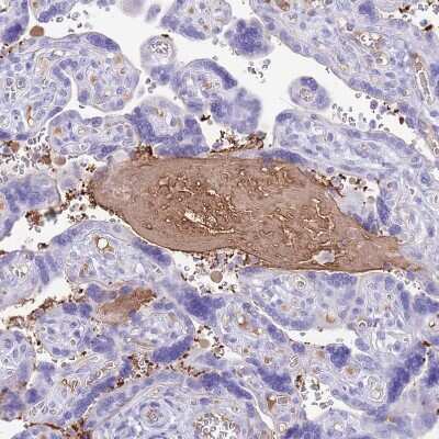 Immunohistochemistry-Paraffin: IGF-I/IGF-1 Antibody [NBP2-48922]