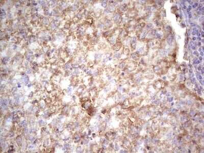 Immunohistochemistry: IGF-I/IGF-1 Antibody (OTI4B12) - Azide and BSA Free [NBP2-71010]