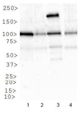 Western Blot: IGF-I R/IGF1R AntibodyBSA Free [NBP1-77680]
