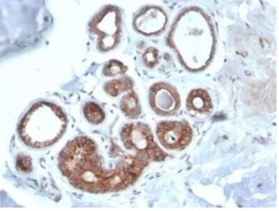 Immunohistochemistry-Paraffin: IGF-I R/IGF1R Antibody (IGF1R/4667) [NBP3-13948]