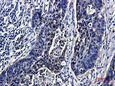 Immunohistochemistry: IGF-I R/IGF1R Antibody (S07-7E1) [NBP3-14897]