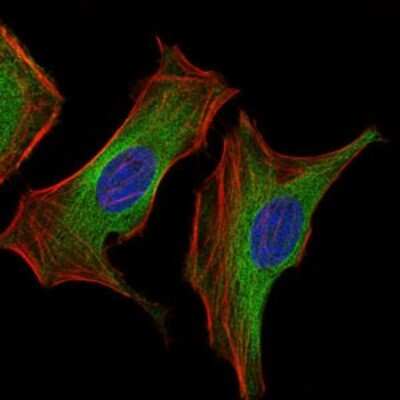 Immunocytochemistry/ Immunofluorescence: IGF-II/IGF2 Antibody (8H1) - BSA Free [NBP2-37462]