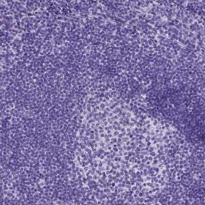 Immunohistochemistry-Paraffin: IGF-II/IGF2 Antibody [NBP2-48510]