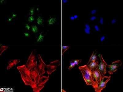Immunocytochemistry/ Immunofluorescence: IGF-II R/IGF2R Antibody (2G11) - Azide and BSA Free [NBP2-80785]