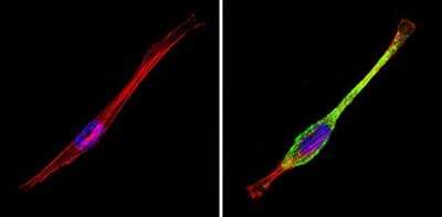 Immunocytochemistry/ Immunofluorescence: IGF-II R/IGF2R Antibody [NB100-74387]