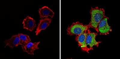 Immunocytochemistry/ Immunofluorescence: IGF-II R/IGF2R Antibody [NB100-74387]