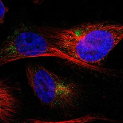 Immunocytochemistry/ Immunofluorescence: IGF-II R/IGF2R Antibody [NBP1-84598]