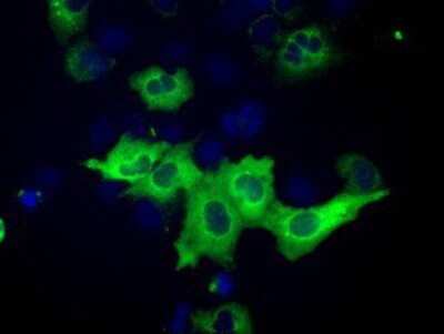 Immunocytochemistry/ Immunofluorescence: IMP2/IGF2BP2 Antibody (OTI3F9) [NBP2-02627]
