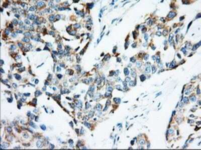 Immunohistochemistry-Paraffin: IMP2/IGF2BP2 Antibody (OTI3F9) [NBP2-02627]