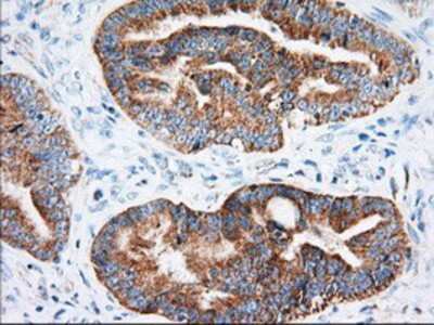 Immunohistochemistry-Paraffin: IMP2/IGF2BP2 Antibody (OTI3F9) [NBP2-02627]