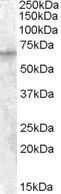 Western Blot: IMP2/IGF2BP2 Antibody [NB100-93408]