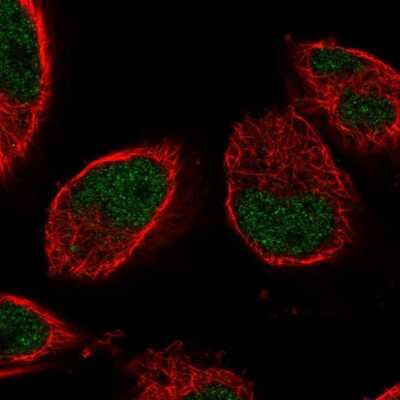 Immunocytochemistry/ Immunofluorescence: IGFALS/ALS Antibody [NBP1-89117]