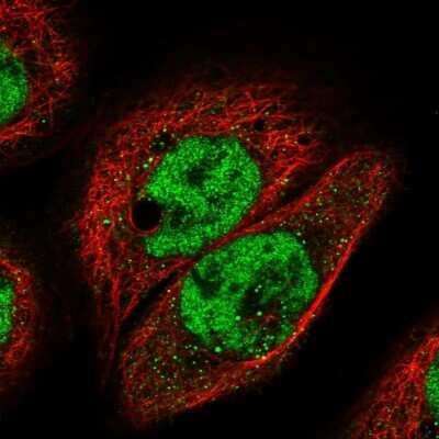 Immunocytochemistry/ Immunofluorescence: IGFALS/ALS Antibody [NBP1-89118]