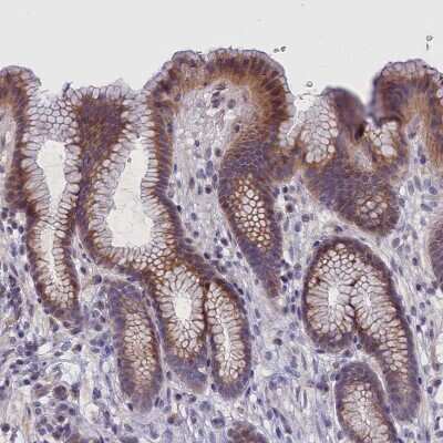 Immunohistochemistry-Paraffin: IGFALS/ALS Antibody [NBP1-89118]