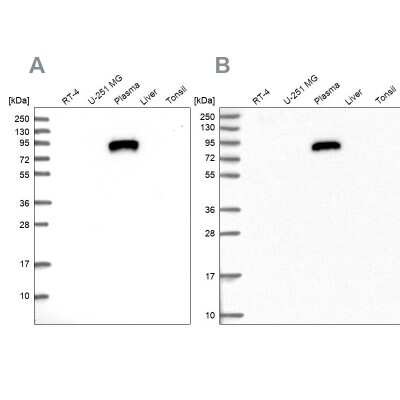 Western Blot: IGFALS/ALS Antibody [NBP1-89118]
