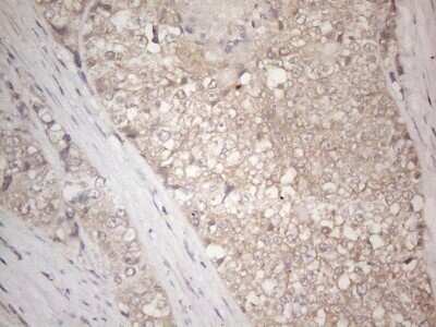 Immunohistochemistry: IGFBP-1 Antibody (OTI6C7) [NBP2-46039]