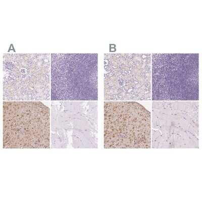 Immunohistochemistry-Paraffin: IGFBP-1 Antibody [NBP2-33475]