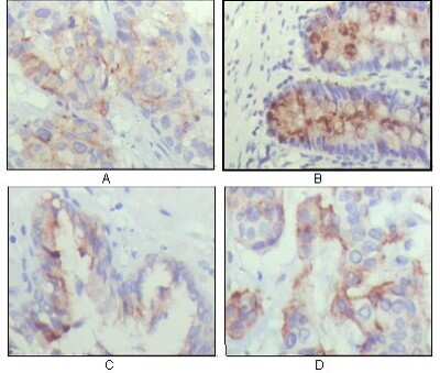 Immunohistochemistry-Paraffin: IGFBP-2 Antibody (1F6F6) - BSA Free [NBP1-28891]