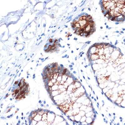 Immunohistochemistry-Paraffin: IGFBP-2 Antibody (4B2G6) [NBP3-16733]