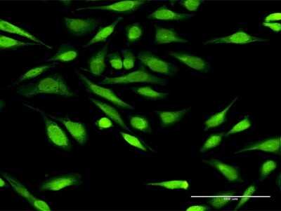 Immunocytochemistry/ Immunofluorescence: IGFBP-3 Antibody [H00003486-D01P]