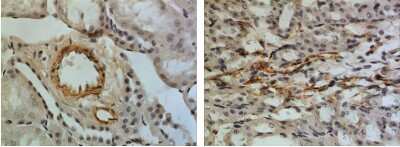 Immunohistochemistry-Paraffin: IGFBP-5 Antibody (RM0097-12C23) - Azide and BSA Free [NBP1-22453]