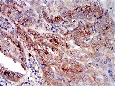 Immunohistochemistry-Paraffin: IGFBP-rp1/IGFBP-7 Antibody (1D9E7) - BSA Free [NBP2-37313]