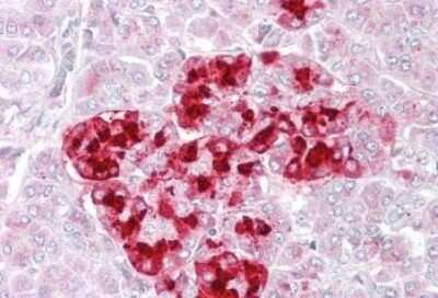 Immunohistochemistry-Paraffin: IGFBP-rp1/IGFBP-7 Antibody [NB100-94904]