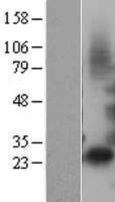 Western Blot: IGFBP-1 Overexpression Lysate [NBL1-11873]