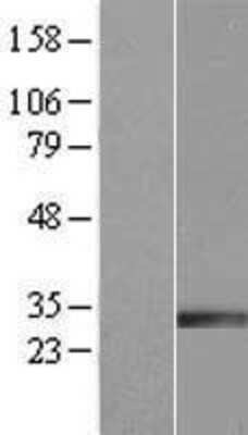 Western Blot: IGFBP-rp1/IGFBP-7 Overexpression Lysate [NBP2-08191]