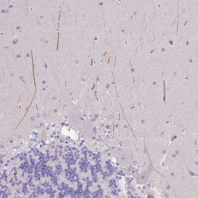 Immunohistochemistry-Paraffin: IGFL4 Antibody [NBP2-14603]