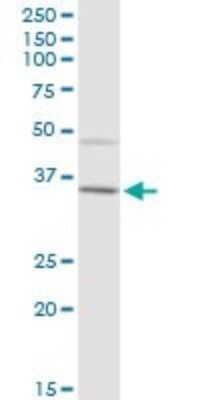 Western Blot: IgA2 Antibody [H00003494-B01P]