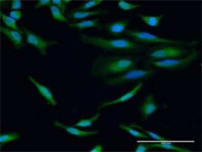 Immunocytochemistry/ Immunofluorescence: IGHG1 Antibody [H00003500-D01P]