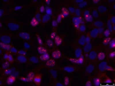 Immunocytochemistry/ Immunofluorescence: IGHMBP2 Antibody [NBP1-68921]