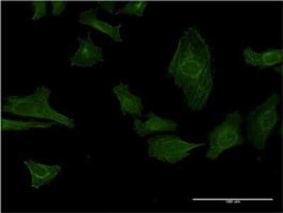 Immunocytochemistry/ Immunofluorescence: IGKV1OR2-108 Antibody (3A11) [H00028862-M01]