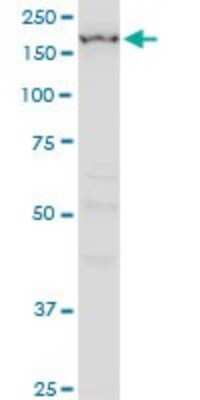 Western Blot: IGSF1 Antibody (4C7) [H00003547-M01]