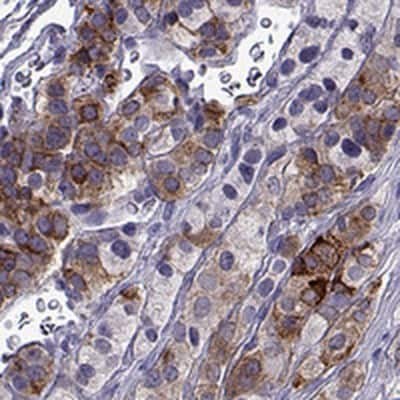 Immunohistochemistry: IGSF1 Antibody [NBP2-68582]