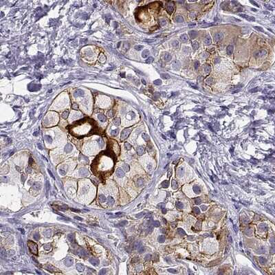 Immunohistochemistry-Paraffin: IGSF1 Antibody [NBP2-14119]